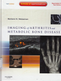 Imaging of Arthritis and Metabolic Bone Disease